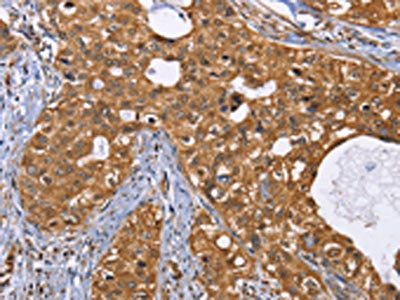 IDH1 Antibody