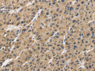 GAS7 Antibody
