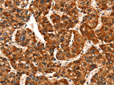 GJA8 Antibody