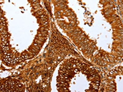 FOXN1 Antibody