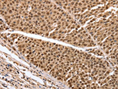 PARP1 Antibody