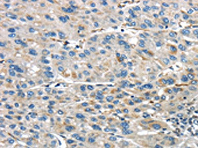 IQGAP2 Antibody