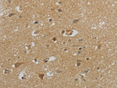 NPHS1 Antibody
