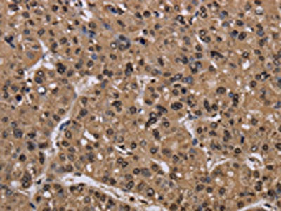 CSNK2A1 Antibody