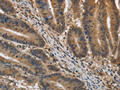 KIF22 Antibody