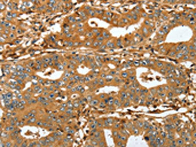 RAP1A Antibody