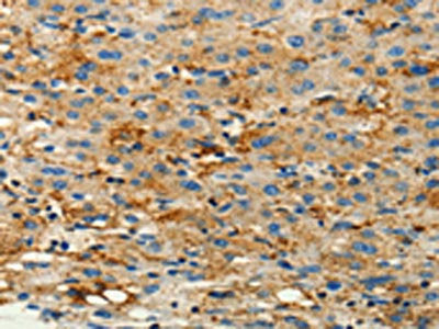 CFTR Antibody