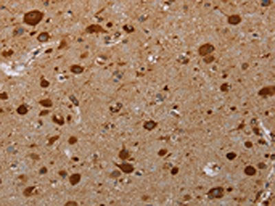 PIM3 Antibody