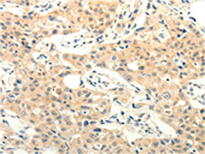 FOXR2 Antibody