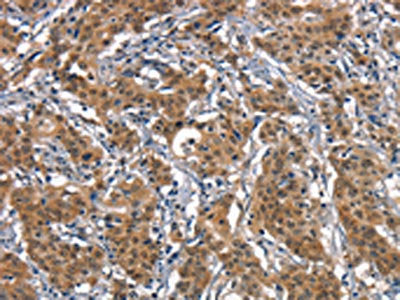 CD163 Antibody