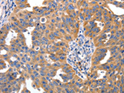 IRS2 Antibody