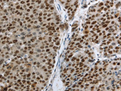 MCM3 Antibody