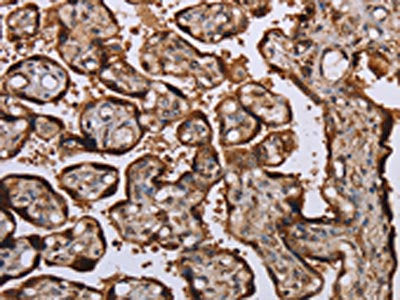 KIF1C Antibody