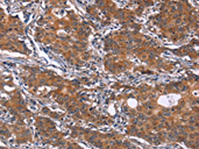 GLS Antibody