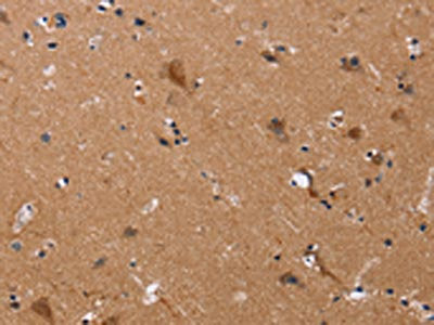 JAG1 Antibody
