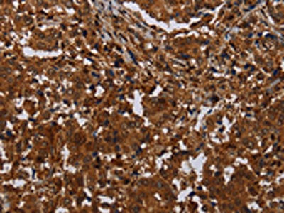 MAGEB18 Antibody