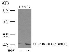 Phospho-MAP2K4 (Ser80) Antibody