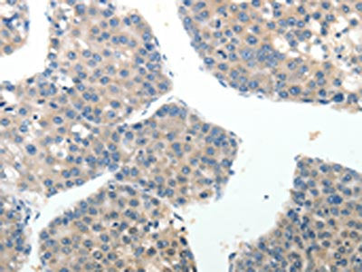 ABI3BP Antibody