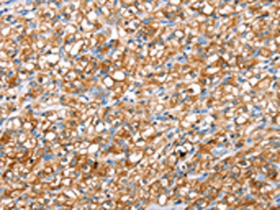 ABCC8 Antibody