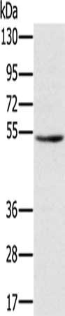 TMPRSS2 Antibody