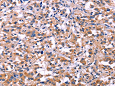 MMP14 Antibody