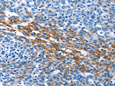PAK6 Antibody