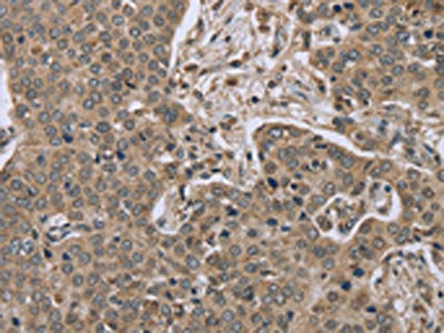 IL15RA Antibody