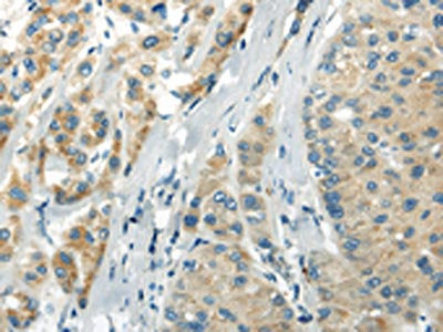 WFDC1 Antibody