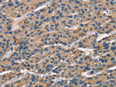 SENP1 Antibody
