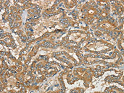 CWC27 Antibody