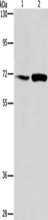 ACADVL Antibody