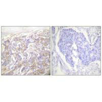 TNFRSF1A Antibody
