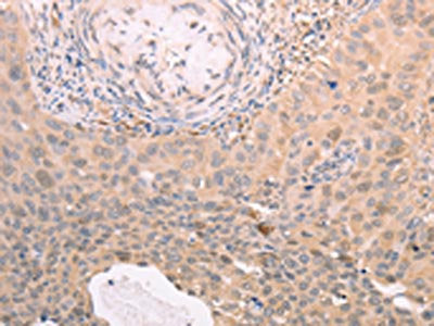TXN Antibody