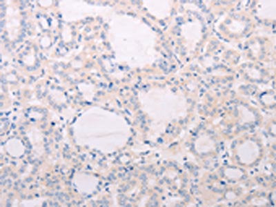 TSHR Antibody