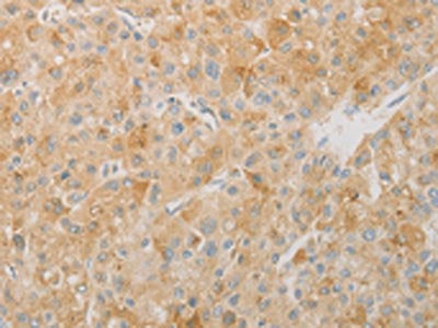 AES Antibody