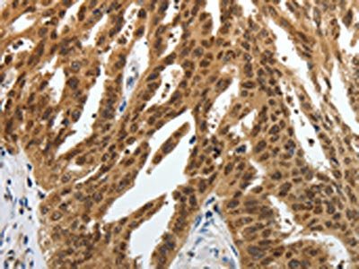 SUMO1 Antibody