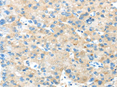 ANGPTL5 Antibody