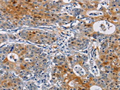 GSTA2 Antibody