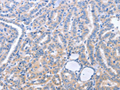B3GAT1 Antibody