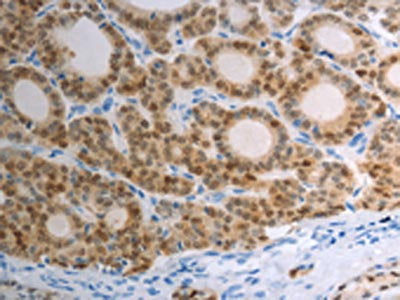 S100A1 Antibody