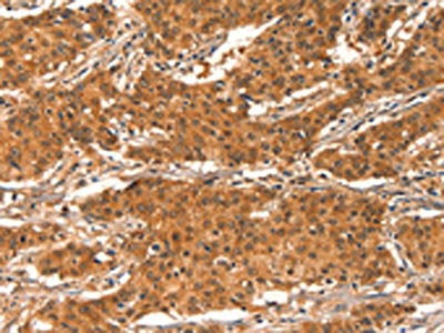 CHUK Antibody