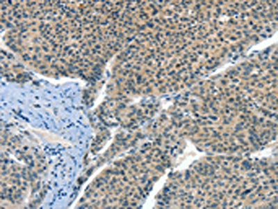 CRLF2 Antibody