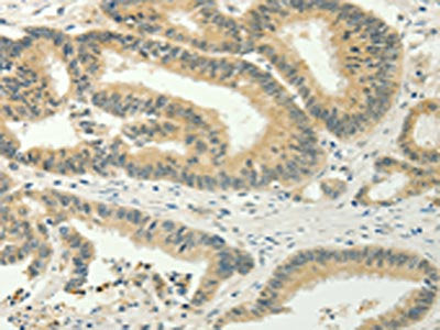 SPIN4 Antibody