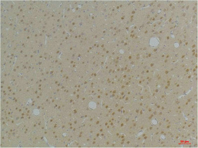 KCNAB1 Antibody