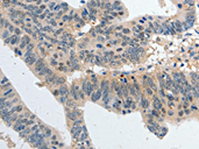 P2RY6 Antibody