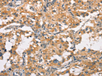 CRHR2 Antibody