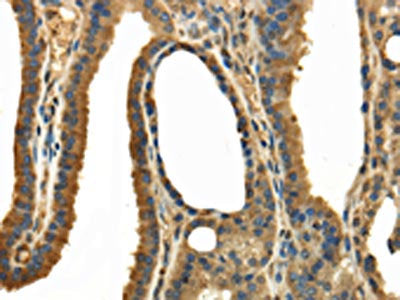 TRPC4AP Antibody