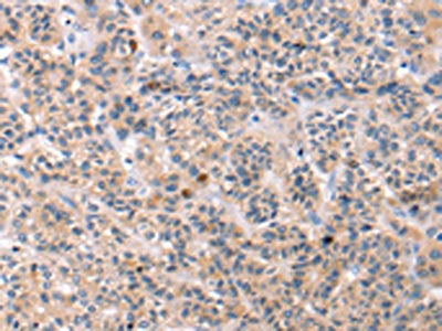 TCERG1L Antibody