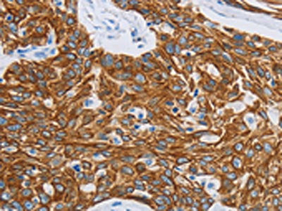 MMP21 Antibody