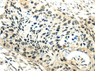 SYNCRIP Antibody